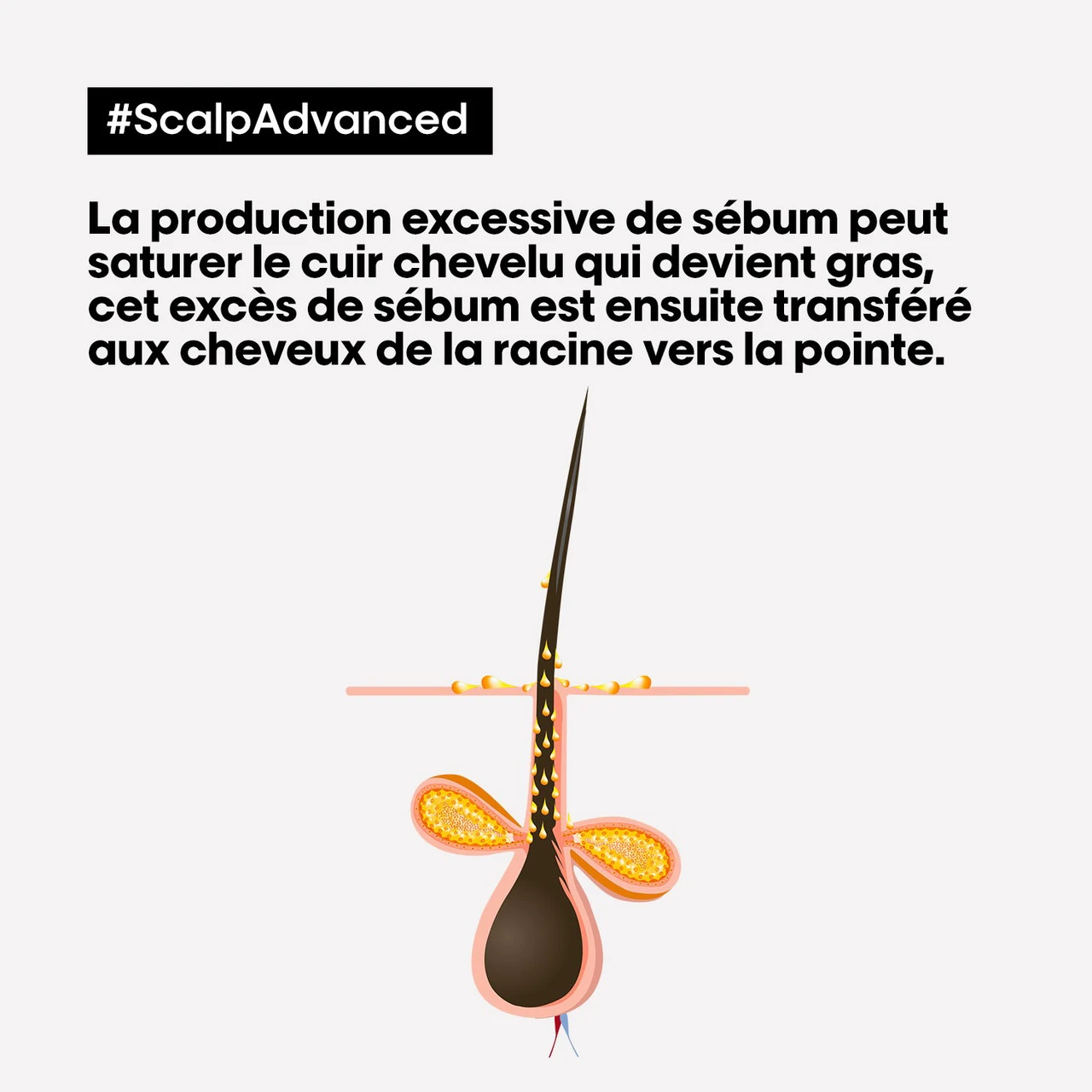 Shampooing Dermo-purifiant Anti Gras Scalp Advanced L'Oréal 1500ml 4 Shampooing Dermo-purifiant Anti Gras Scalp Advanced L'Oréal 1500ml – Image 4